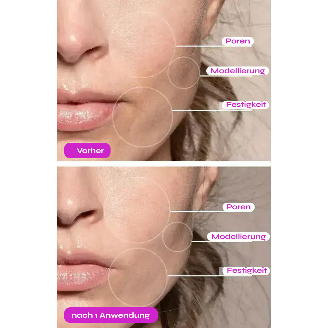 SkinLift® - 7 in 1 Facial Sculptor