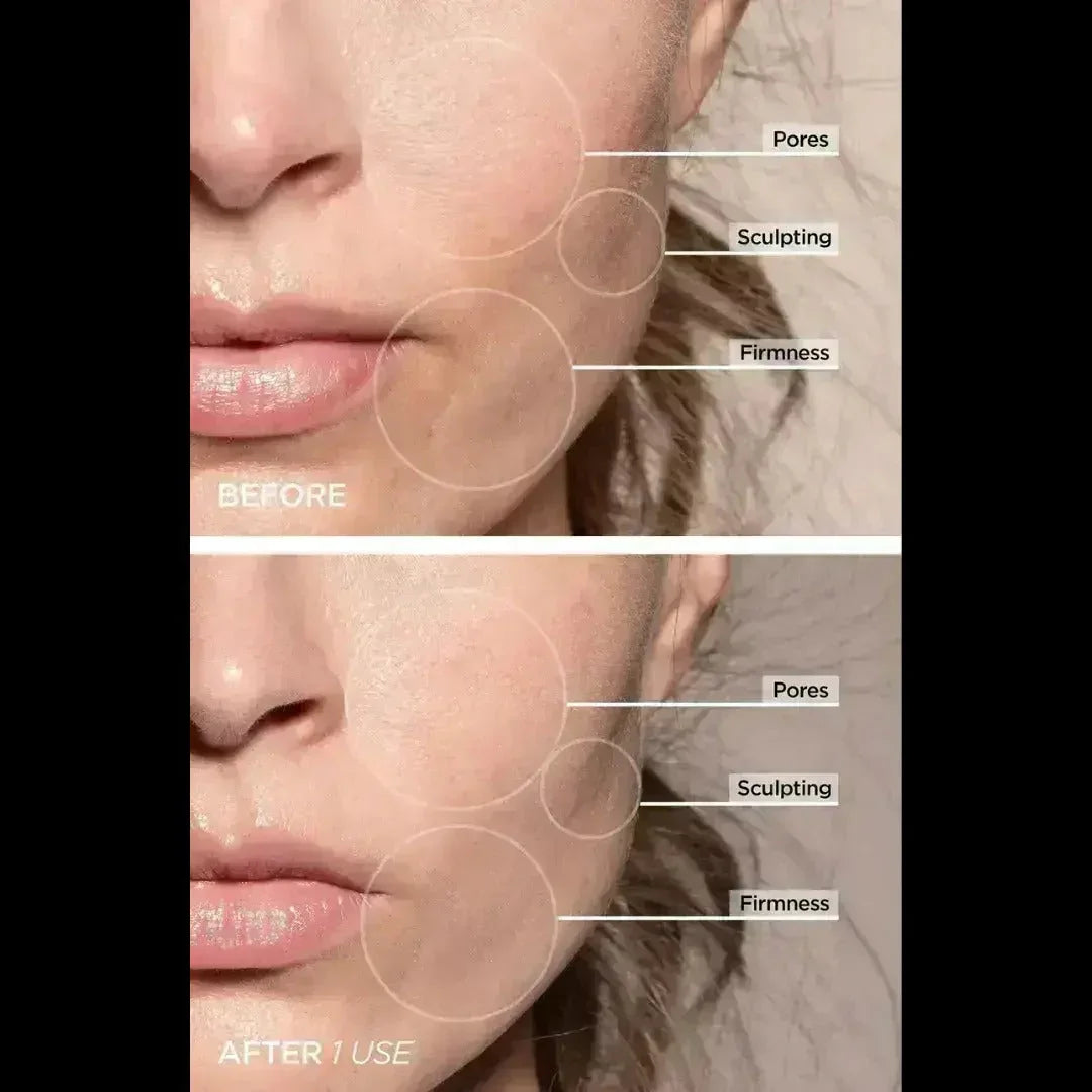 SkinLift® - 7 in 1 Facial Sculptor