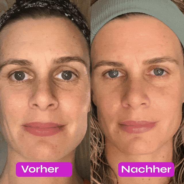 SkinLift® - 7 in 1 Facial Sculptor 