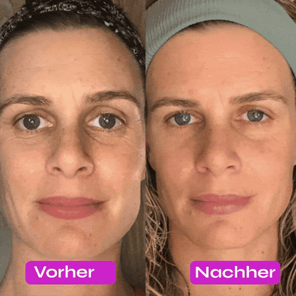 SkinLift® - 7 in 1 Facial Sculptor 