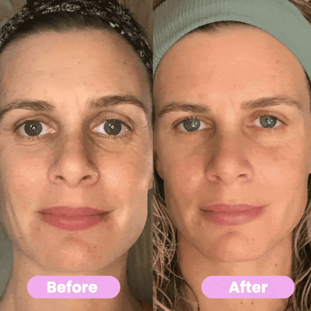 SkinLift® - 7 in 1 Facial Sculptor